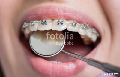 fotolia 168839577